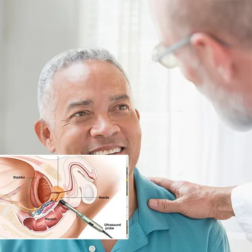 Welcome to  Urology San Antonio 
: Comprehensive Penile Implant Care for Everyone